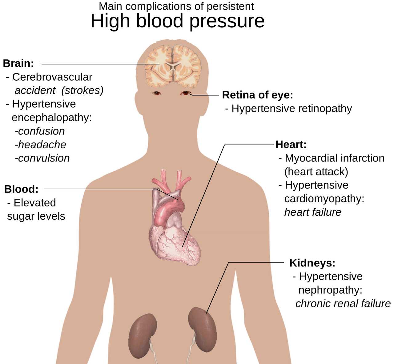 erfahren sie alles wichtige über bluthochdruck (hypertonie): ursachen, symptome, behandlungsmöglichkeiten und tipps zur vorbeugung für ein gesundes leben.